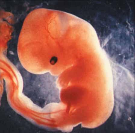 四个月胎儿图